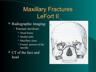 Maxillary Fractures
                  LeFort II
 Radiographic        imaging:
  – Fracture involves:
          Nasal bones
          Medial orbit
          Maxillary sinus
          Frontal process of the
           maxilla
 CT of the face and
  head
 