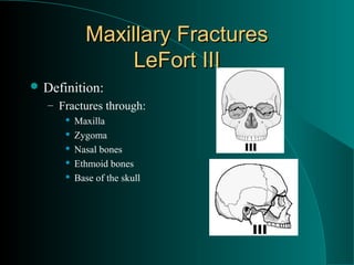 Maxillary Fractures
                 LeFort III
 Definition:
   – Fractures through:
         Maxilla
         Zygoma
         Nasal bones
         Ethmoid bones
         Base of the skull
 