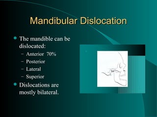 Mandibular Dislocation
 The  mandible can be
  dislocated:
                         
   – Anterior 70%
   – Posterior
   – Lateral
   – Superior
 Dislocations are
  mostly bilateral.
 