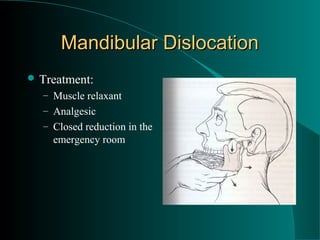 Mandibular Dislocation
 Treatment:
  – Muscle relaxant
  – Analgesic
  – Closed reduction in the
    emergency room
 