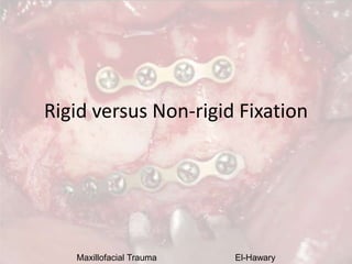 Maxillofacial Trauma El-Hawary
Rigid versus Non-rigid Fixation
 