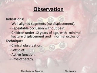 Maxillofacial Trauma El-Hawary
Observation
Indications:
- Well aligned segments (no displacement).
- Repeatable occlusion ...