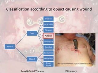 Maxillofacial Trauma El-Hawary
Classification according to object causing wound
wound
Open
Incision
Laceration
Abrasion
Pu...