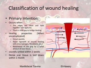 Maxillofacial Trauma El-Hawary
Classification of wound healing
• Primary Intention
• Occurs when:
– The edges are clean an...