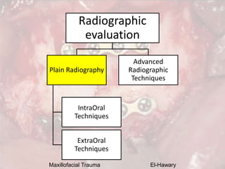 Maxillofacial Trauma El-Hawary
Radiographic
evaluation
Plain Radiography
IntraOral
Techniques
ExtraOral
Techniques
Advance...