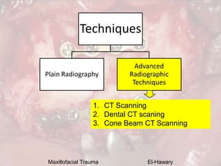 Maxillofacial Trauma El-Hawary
Techniques
Plain Radiography
Advanced
Radiographic
Techniques
1. CT Scanning
2. Dental CT s...
