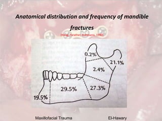 Maxillofacial Trauma El-Hawary
Anatomical distribution and frequency of mandible
fractures
(Haug, Parather, Indresano, 199...