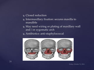  Closed reduction 
 Intermaxillary fixation: secures maxilla to 
mandible 
 May need wiring or plating of maxillary wall 
and / or zygomatic arch 
 Antibiotics: anti-staphylococcal 
 