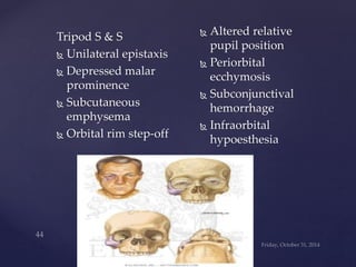 Tripod S & S 
 Unilateral epistaxis 
 Depressed malar 
prominence 
 Subcutaneous 
emphysema 
 Orbital rim step-off 
 Altered relative 
pupil position 
 Periorbital 
ecchymosis 
 Subconjunctival 
hemorrhage 
 Infraorbital 
hypoesthesia 
 