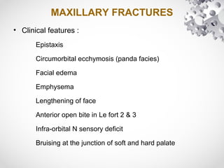 MAXILLARY FRACTURES
• Clinical features :
Epistaxis
Circumorbital ecchymosis (panda facies)
Facial edema
Emphysema
Lengthening of face
Anterior open bite in Le fort 2 & 3
Infra-orbital N sensory deficit
Bruising at the junction of soft and hard palate
 