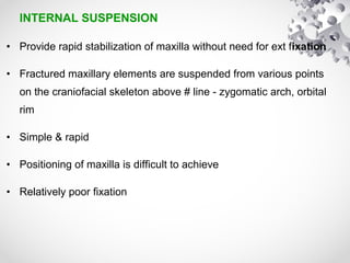 INTERNAL SUSPENSION
• Provide rapid stabilization of maxilla without need for ext fixation
• Fractured maxillary elements are suspended from various points
on the craniofacial skeleton above # line - zygomatic arch, orbital
rim
• Simple & rapid
• Positioning of maxilla is difficult to achieve
• Relatively poor fixation
 
