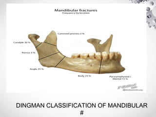 DINGMAN CLASSIFICATION OF MANDIBULAR
#
 