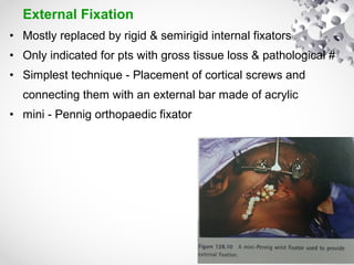 External Fixation
• Mostly replaced by rigid & semirigid internal fixators
• Only indicated for pts with gross tissue loss & pathological #
• Simplest technique - Placement of cortical screws and
connecting them with an external bar made of acrylic
• mini - Pennig orthopaedic fixator
 