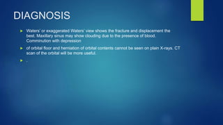 DIAGNOSIS
 Waters’ or exaggerated Waters’ view shows the fracture and displacement the
best. Maxillary sinus may show clouding due to the presence of blood.
Comminution with depression
 of orbital floor and herniation of orbital contents cannot be seen on plain X-rays. CT
scan of the orbital will be more useful.
 .
 