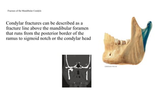 MAXILLOFACIAL TRAUMA oral surgery topics | PPTX
