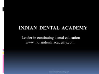 INDIAN DENTAL ACADEMY
Leader in continuing dental education
www.indiandentalacademy.com

www.indiandentalacademy.com

 