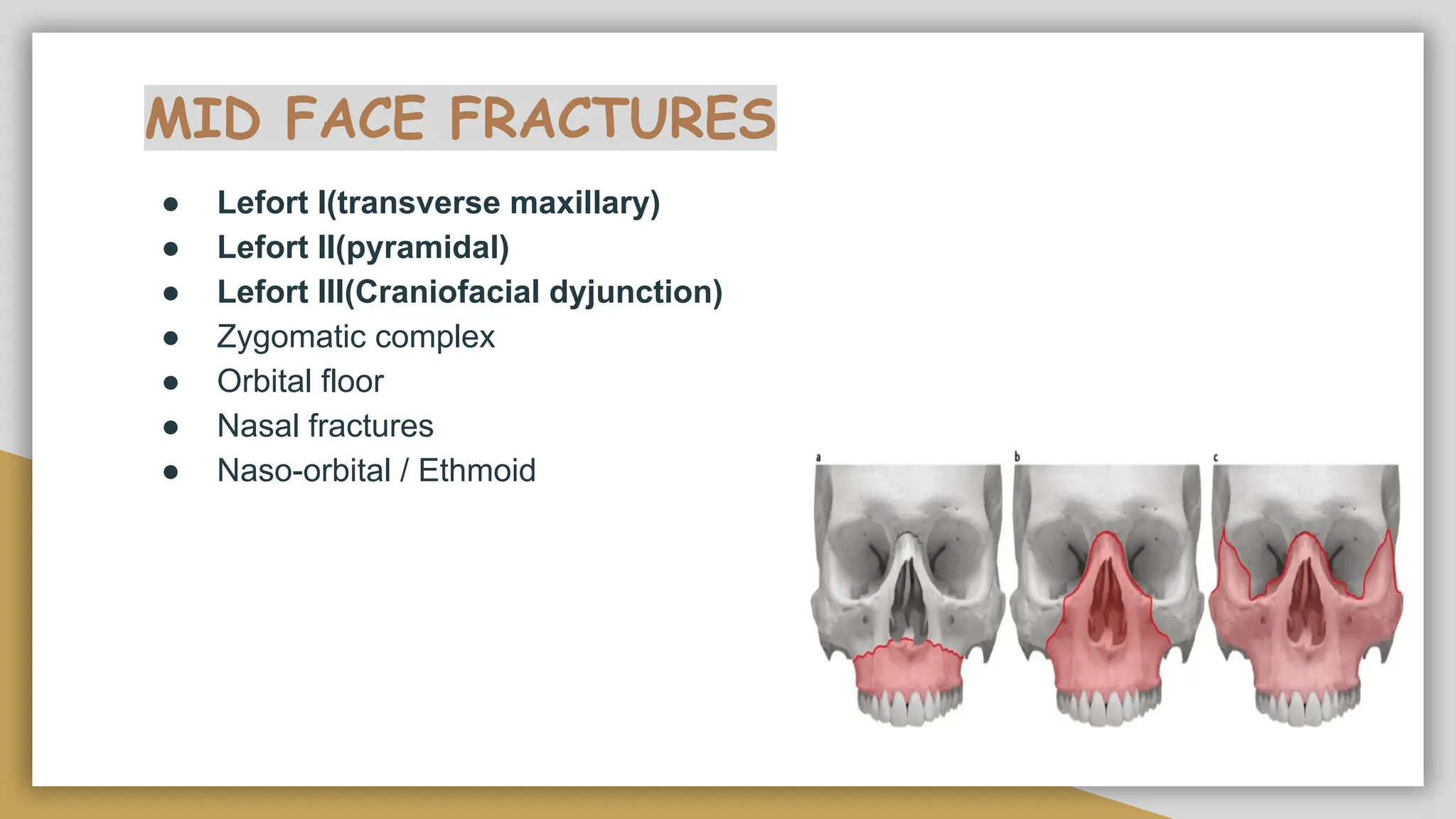 Lefort Injuries MAXILLOFACIAL TRAUMA presented by doctor shamma | PDF