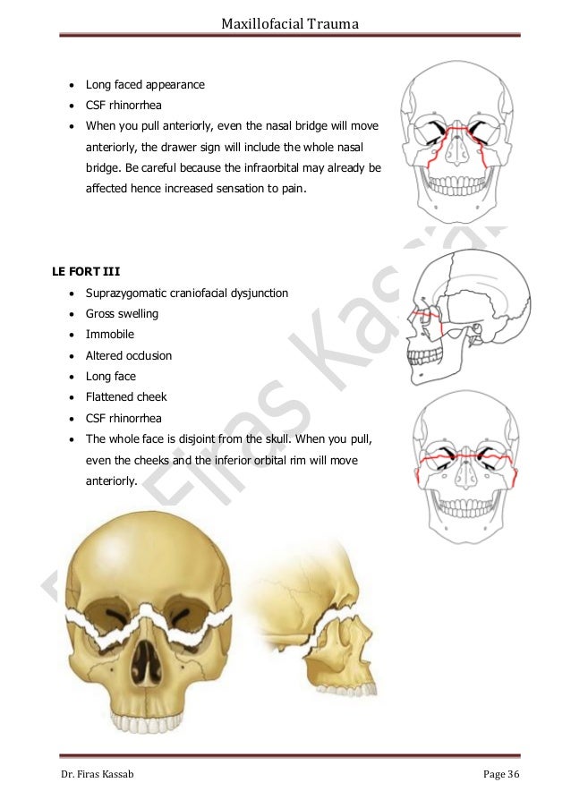 Maxillofacial Trauma 2