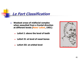 Fort Classification Maxillofacial Trauma emergency management.ppt