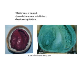 •Master cast is poured.
•Jaw relation record established.
•Teeth setting is done.
www.indiandentalacademy.com
 