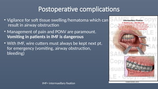 Postoperative complications
• Vigilance for soft tissue swelling/hematoma which can
result in airway obstruction
• Management of pain and PONV are paramount.
Vomiting in patients in IMF is dangerous
• With IMF, wire cutters must always be kept next pt.
for emergency (vomiting, airway obstruction,
bleeding)
IMF= intermaxillary fixation
 