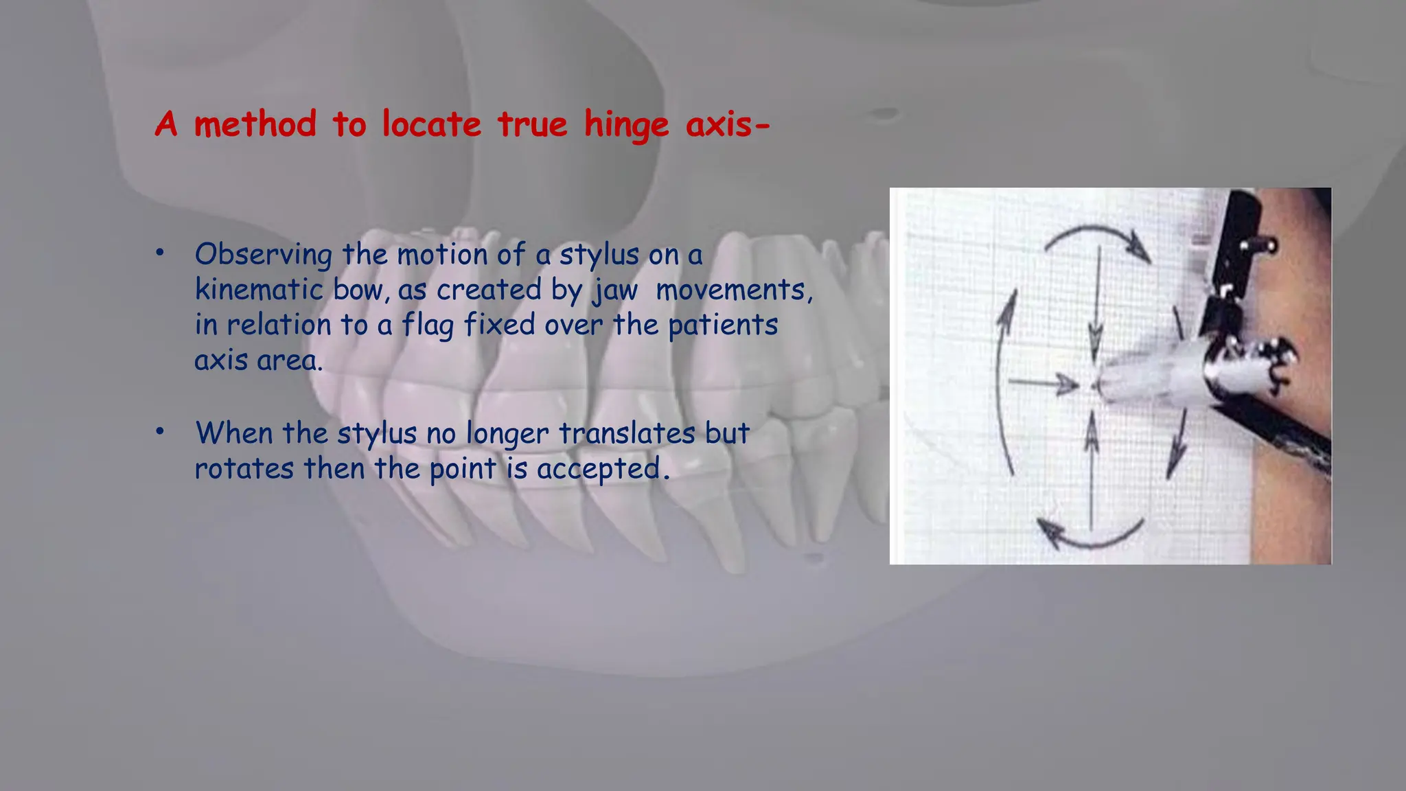 MAXILLO MANDIBULAR RELATIONS IN COMPLETE DENTURE PROSTHODONTICS | PPTX