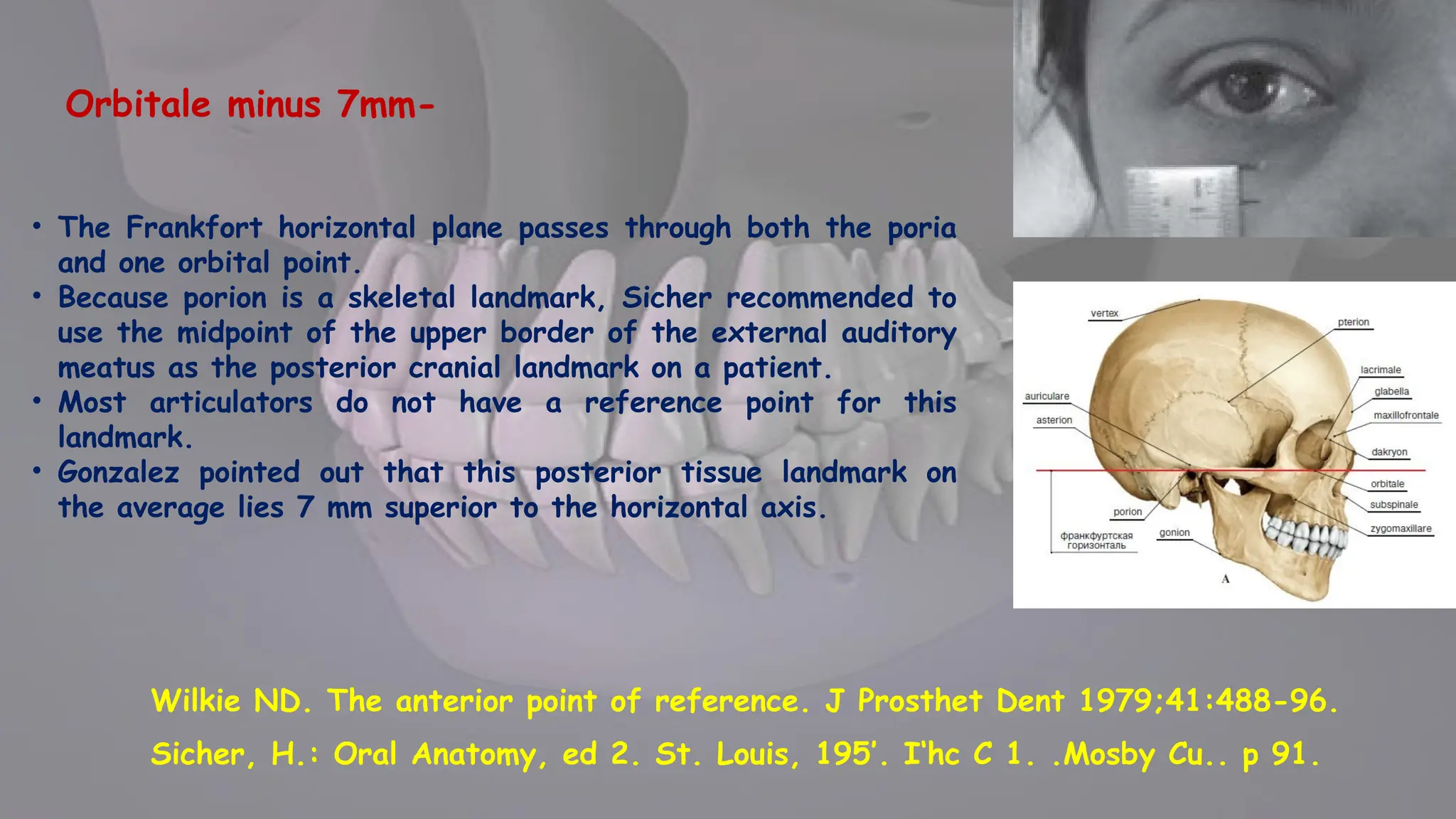 MAXILLO MANDIBULAR RELATIONS IN COMPLETE DENTURE PROSTHODONTICS | PPTX