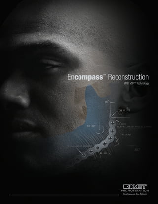Encompass™
Reconstruction
With VSP®
Technology
 