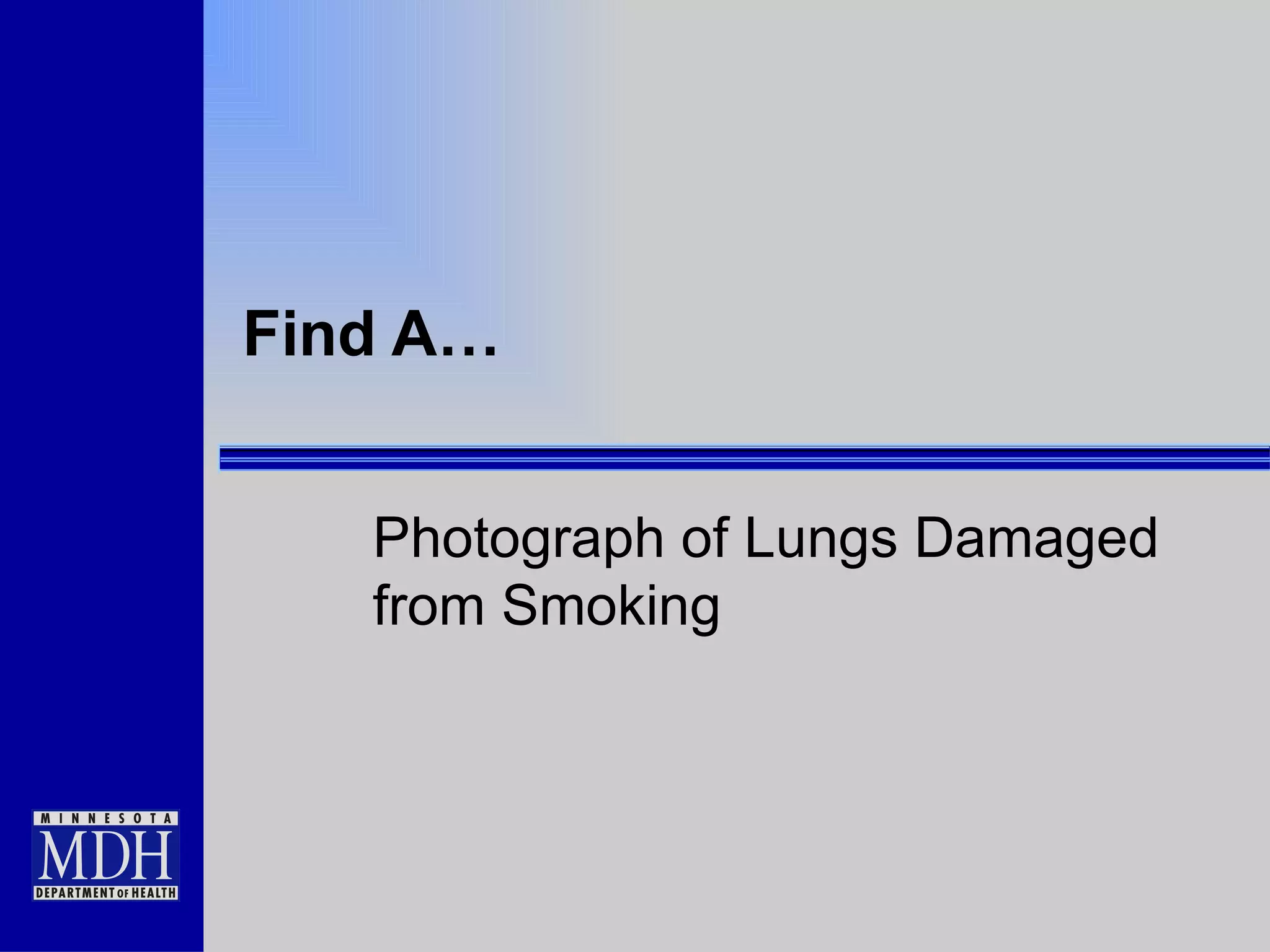 Find A… Photograph of Lungs Damaged from Smoking 