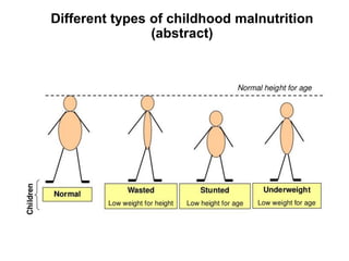 Different types of childhood malnutrition
(abstract)
 