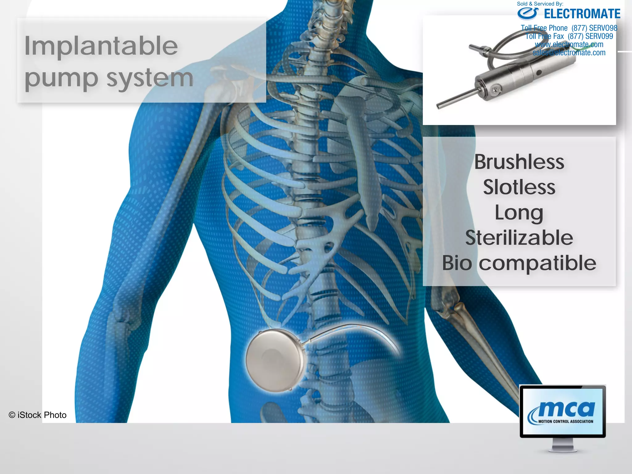Implantable
pump system
© iStock Photo
Brushless
Slotless
Long
Sterilizable
Bio compatible
ELECTROMATE
Toll Free Phone (877) SERVO98
Toll Free Fax (877) SERV099
www.electromate.com
sales@electromate.com
Sold & Serviced By:
 