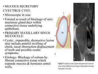 Maxillary sinus anatomy and sinus agumentation | PDF