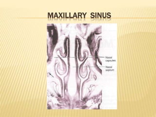 MAXILLARY SINUS
 