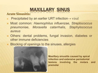 MAXILLARY SINUS
Acute Sinusitis:
 Precipitated by an earlier URT infection→ viral
 Most common: Haemophilus influenzae, Streptococcus
pneumoniae, Moraxella catarrhalis, Staphylococcus
aureus
 Others: dental problems, fungal invasion, diabetes or
other immune deficiencies
 Blocking of openings to the sinuses, allergies
Maxillary sinusitis caused by apical
infection and extensive periodontal
lesions involving the molars and
premolar
 