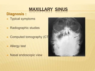 MAXILLARY SINUS
Diagnosis :
 Typical symptoms
 Radiographic studies
 Computed tomography (CT)
 Allergy test
 Nasal endoscopic view
 