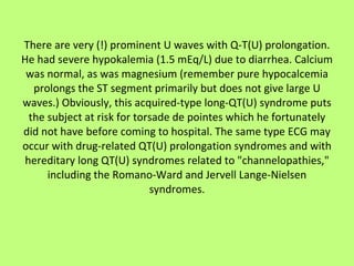 There are very (!) prominent U waves with Q-T(U) prolongation. He had severe hypokalemia (1.5 mEq/L) due to diarrhea. Calcium was normal, as was magnesium (remember pure hypocalcemia prolongs the ST segment primarily but does not give large U waves.) Obviously, this acquired-type long-QT(U) syndrome puts the subject at risk for torsade de pointes which he fortunately did not have before coming to hospital. The same type ECG may occur with drug-related QT(U) prolongation syndromes and with hereditary long QT(U) syndromes related to "channelopathies," including the Romano-Ward and Jervell Lange-Nielsen syndromes. 