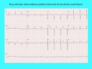 66-yr-old male: what evidence (subtle) is there that he has chronic renal failure? 
