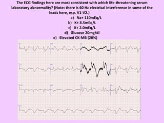 The ECG findings here are most consistent with which life-threatening serum laboratory abnormality? (Note: there is 60 Hz electrical interference in some of the leads here, esp. V1-V2.)    a)   Na+ 110mEq/L b)   K+ 8.5mEq/L c)   K+ 2.0mEq/L d)   Glucose 20mg/dl e)   Elevated CK-MB (20%) 