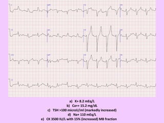 a)   K+ 8.2 mEq/L b)   Ca++ 15.2 mg/dL c)   TSH >100 microU/ml (markedly increased) d)   Na+ 110 mEq/L e)   CK 3500 IU/L with 15% (increased) MB fraction 