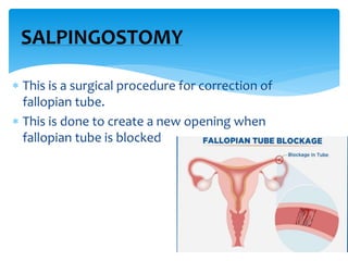 IN VITRO FERTILIZATION
 Fertilization of ovum outside
the body is a technique used
when a women has blocked
fallopian tub...