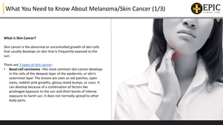 All You Need to Know About Melanoma/Skin Cancer | PPTX
