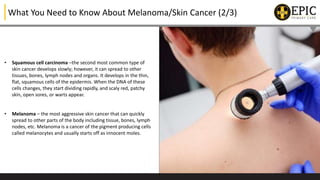 All You Need to Know About Melanoma/Skin Cancer | PPTX