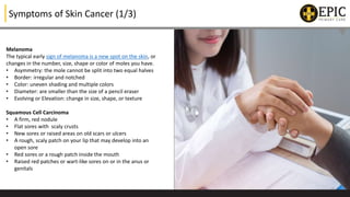 All You Need to Know About Melanoma/Skin Cancer | PPTX