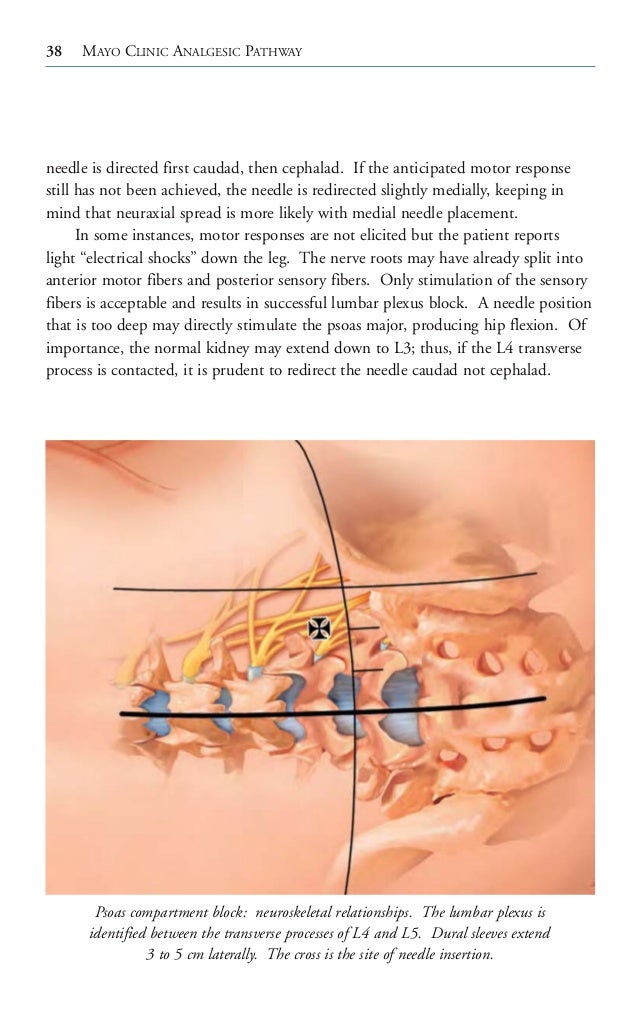 Mayo clinic analgesic pathway peripheral nerve blockade