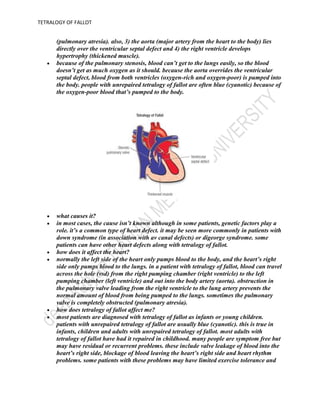 endocarditis prevention