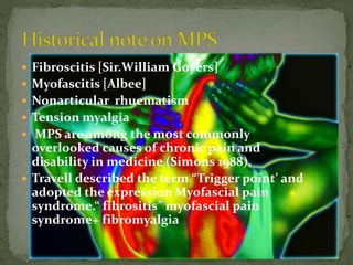  Fibroscitis [Sir.William Goyers]
 Myofascitis [Albee]
 Nonarticular rhuematism
 Tension myalgia
 MPS are among the most commonly
overlooked causes of chronic pain and
disability in medicine (Simons 1988).
 Travell described the term “Trigger point’ and
adopted the expression Myofascial pain
syndrome.“ fibrositis” myofascial pain
syndrome+ fibromyalgia
 