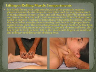  It is handy for use with large muscles,such as the pectoralis major or
gluteus maximus,this technique is most often used for long muscles such
as the quadriceps, biceps, triceps, and calf muscles. Slowly lift the muscle
away from the bone and roll it until resistance is felt.This technique is very
useful to improve “tracking”of joints that are disrupted by torsion—forces
that occur when muscles are not exerting their force in the proper line in
relation to the joint. The sternocleidomastoid muscle needs to be free from
adhesions to adjacent muscles in order to properly shorten and have a clear
line of pull to turn the head. Lifting the muscle with fingers (or knuckles)
and rolling or mobilizing with shearing force.
 
