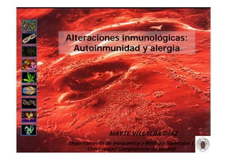 Alteraciones inmunológicas:
  Autoinmunidad y alergia




               MAYTE VILLALBA DÍAZ
Departamento de Bioquímica y Biología Molecular I
       Universidad Complutense de Madrid
 