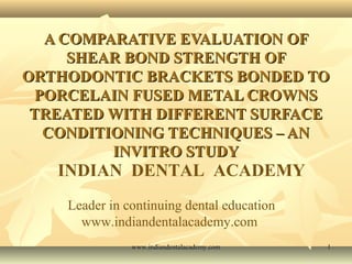 A COMPARATIVE EVALUATION OF
SHEAR BOND STRENGTH OF
ORTHODONTIC BRACKETS BONDED TO
PORCELAIN FUSED METAL CROWNS
TREATED WITH DIFFERENT SURFACE
CONDITIONING TECHNIQUES – AN
INVITRO STUDY

INDIAN DENTAL ACADEMY
Leader in continuing dental education
www.indiandentalacademy.com
www.indiandentalacademy.com

1

 