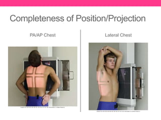 Image Evaluation: Stretcher Chest | PPTX